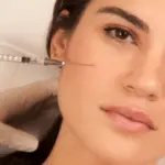 20% Matrixyl Collagen Serum Review: Full Guide