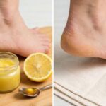 Quick Healing Method for Dry Cracked Heels Using Simple Kitchen Ingredients