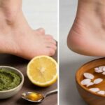 Quick Ways to Heal Dry Cracked Heels at Home Using Safe and Effective Kitchen Ingredients